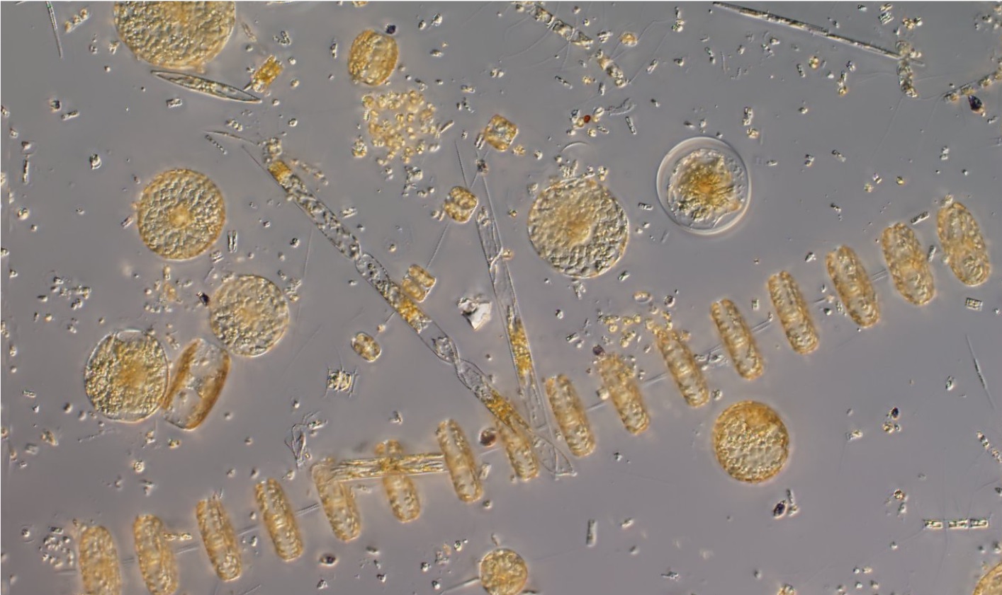Phytoplankton, credit Alyce Hancock