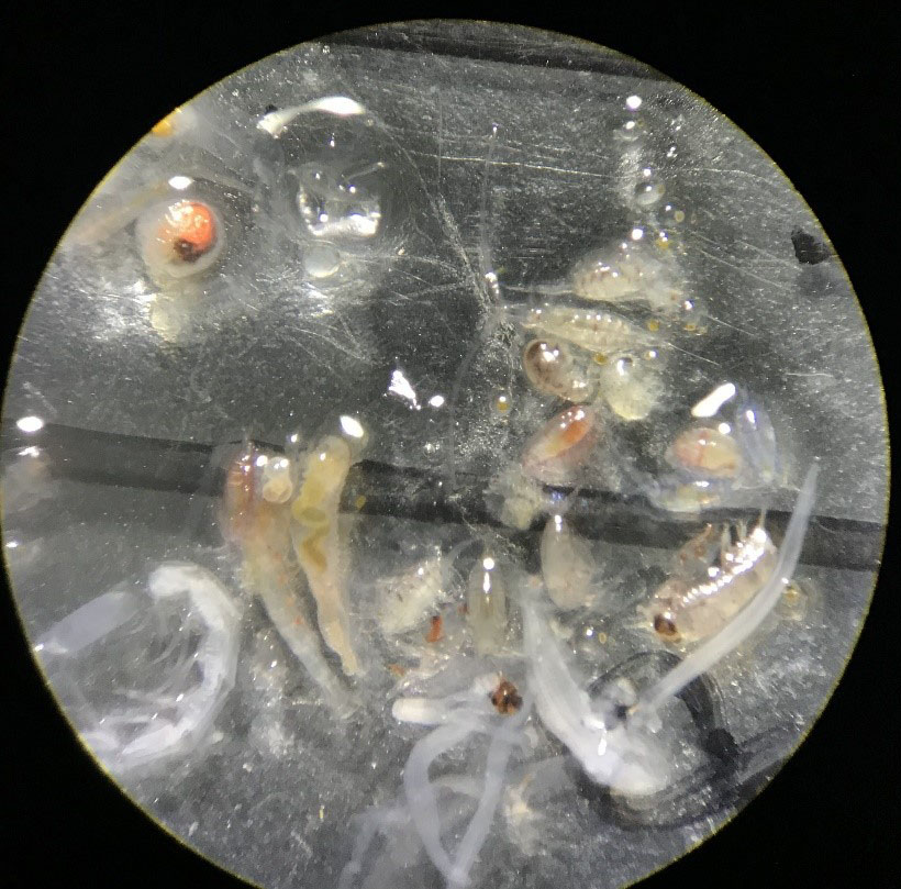 Zooplankton under microscope
